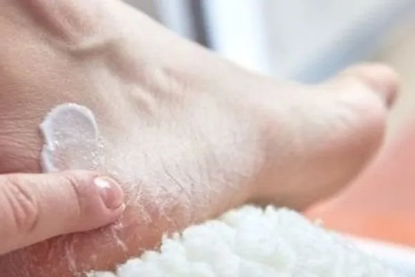 Remedies for Cracked Heels: फटी एड़ियों को कोमल बनाने के 5 उपाय