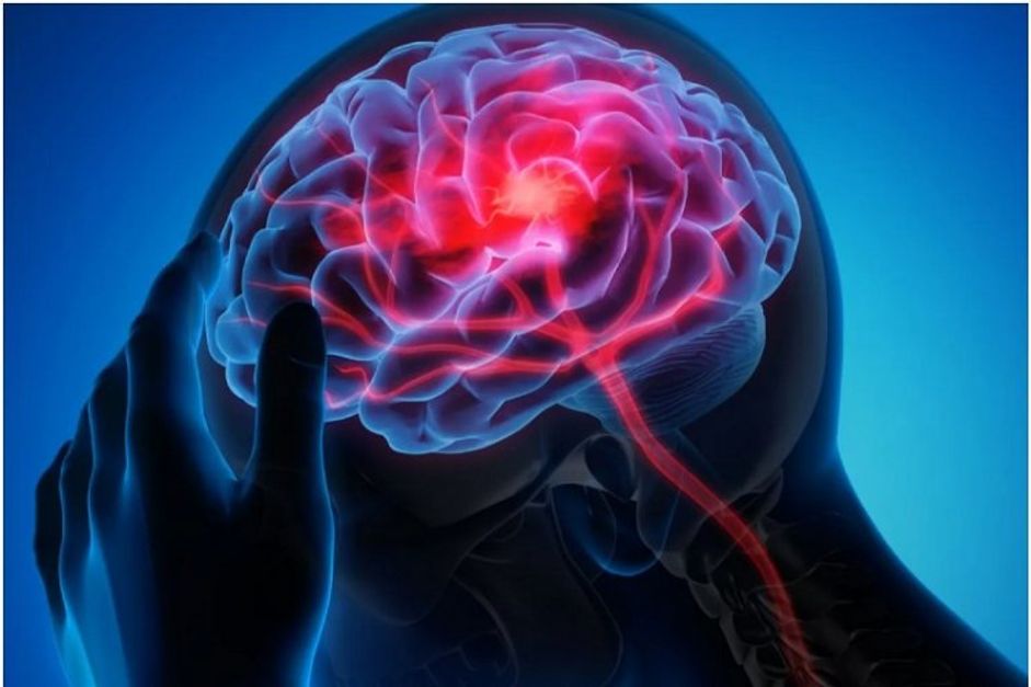 Silent, subtle and unseen How seizures happen and why they're hard to