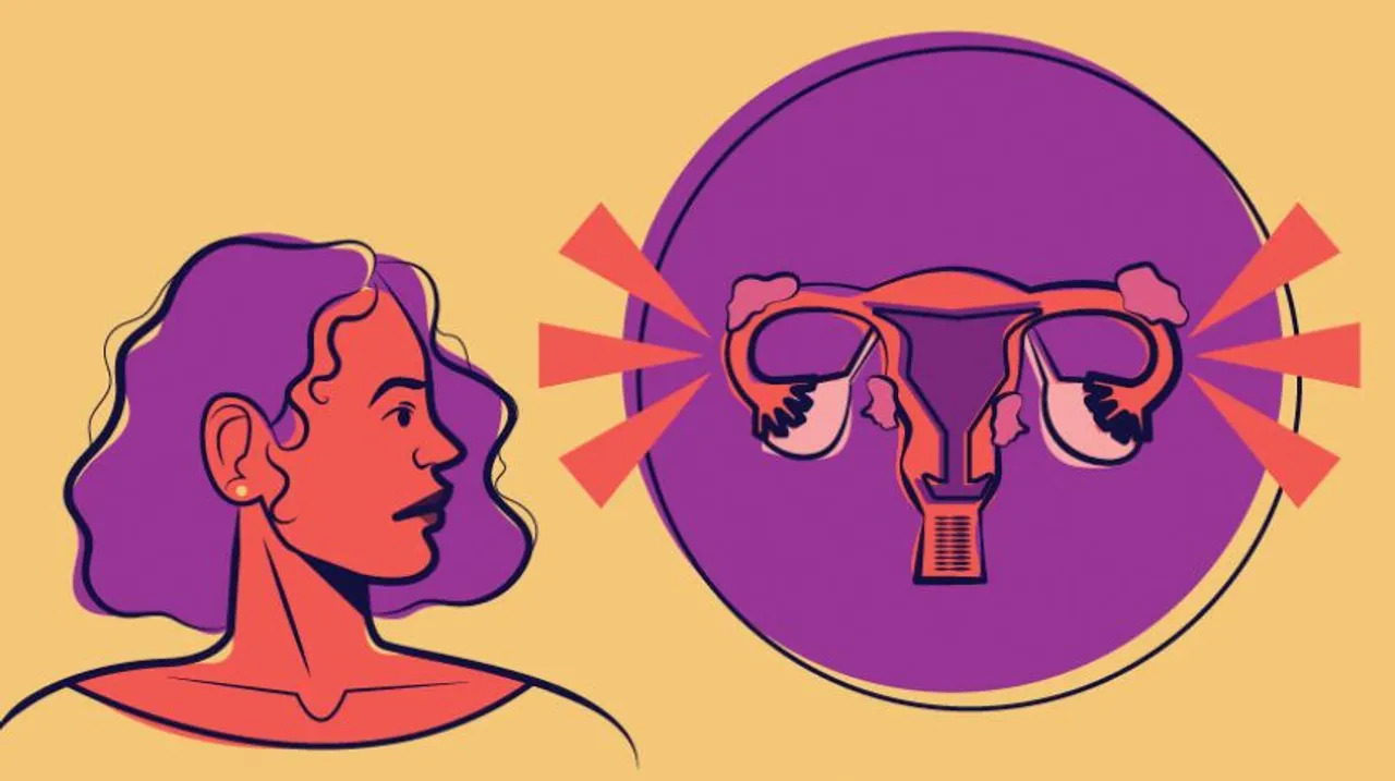 Endometriosis: एंडोमेट्रियोसिस महिलाओं में होने वाली गंभीर समस्या