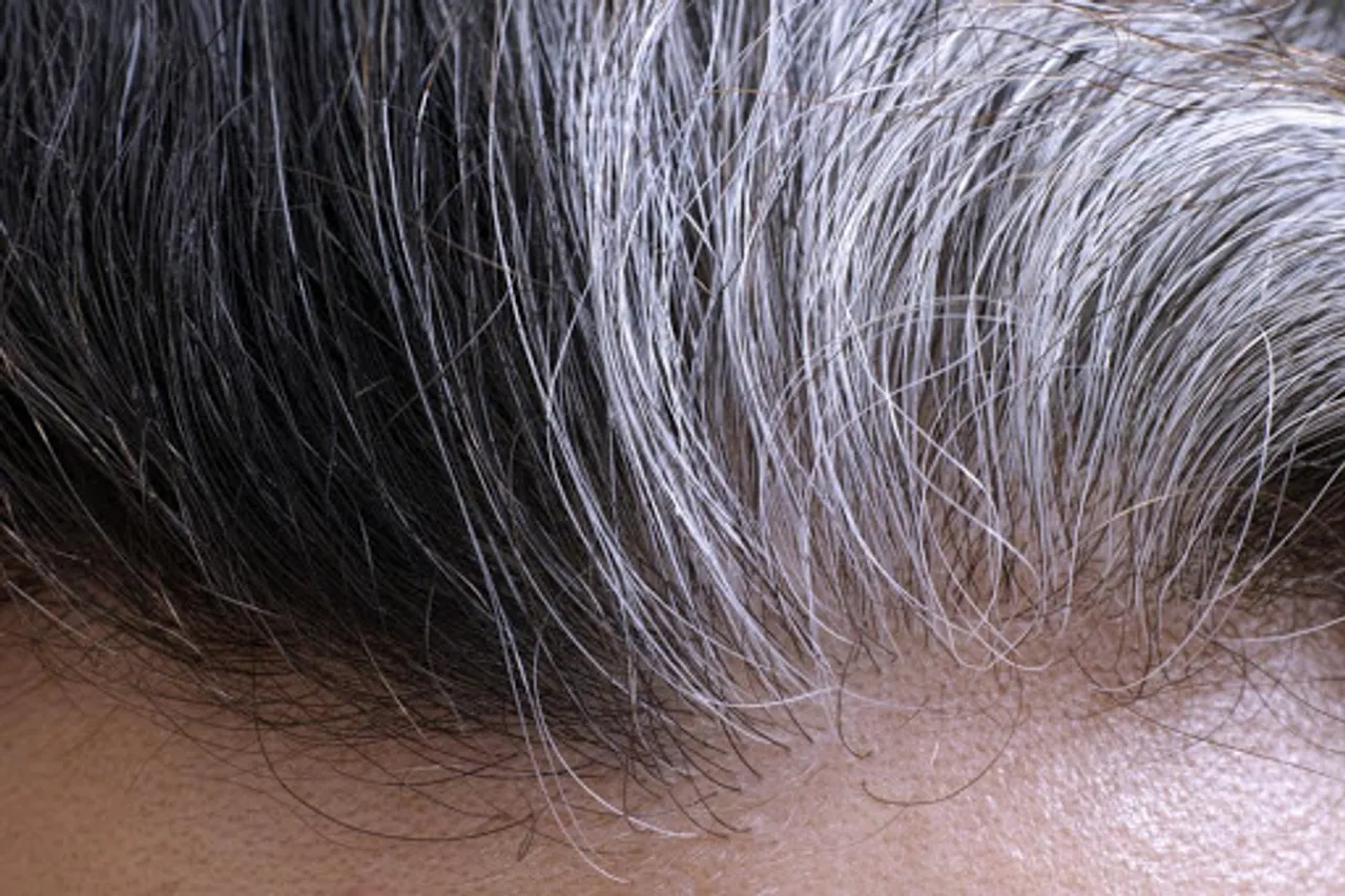 White Hair Solution In Hindi : सफेद बालो से छुटकारा पाने के लिए अपनाये ये 5  घरेलु