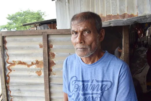 Amal Biswas, who was attacked in March 1990, still has scars on his nose, left cheek and neck. Pic: Partho Burman 30stades