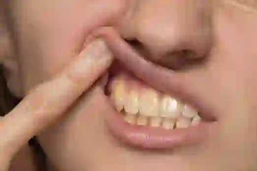 Remedies For Pyorrhea: दांतो मे होने वाले पायरिया को कैसे रोकें? जानिए ये 5 घरेलू उपचार