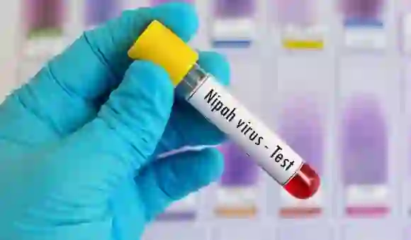 Nipaah Virus Alert : निपाह वायरस के चलते ज़मीन पर गिरे और बिना धुले फल खाने को लेकर एक्सपर्ट ने चेतावनी दी