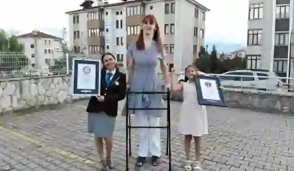 World's Tallest Woman: क्या आप जानते हैं कि दुनिया में सबसे लंबी महिला कौन है?