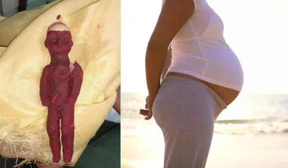 Fake Pregnancy: उत्तर प्रदेश की महिला ने पेंट की हुई प्लास्टिक की गुड़िया का उपयोग करके फेक प्रेगनेंसी का नाटक किया