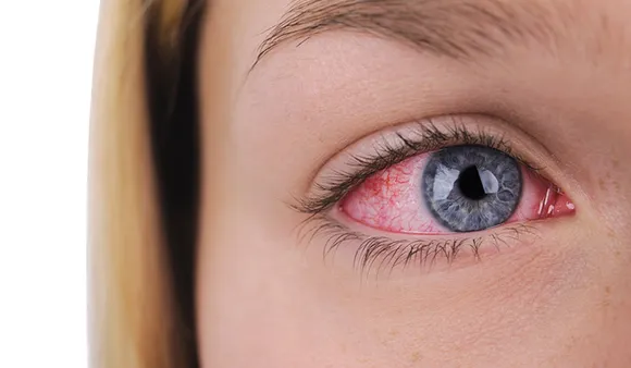 Tips To Reduce Eye Strain: आंखों के स्ट्रेन को कम करने के लिए 5 टिप्स