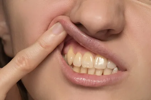 How To Stop Infection Of Pyorrhea :पायरिया से खराब हो रहे दातों को कैसे ठीक करे